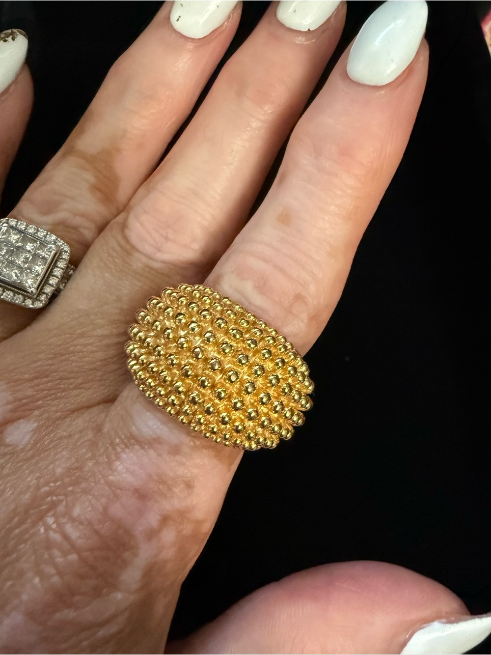 EPIC RING - Picture 10 of 14